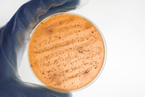 Видове дрожди и техните свойства при използването им в пивоварството